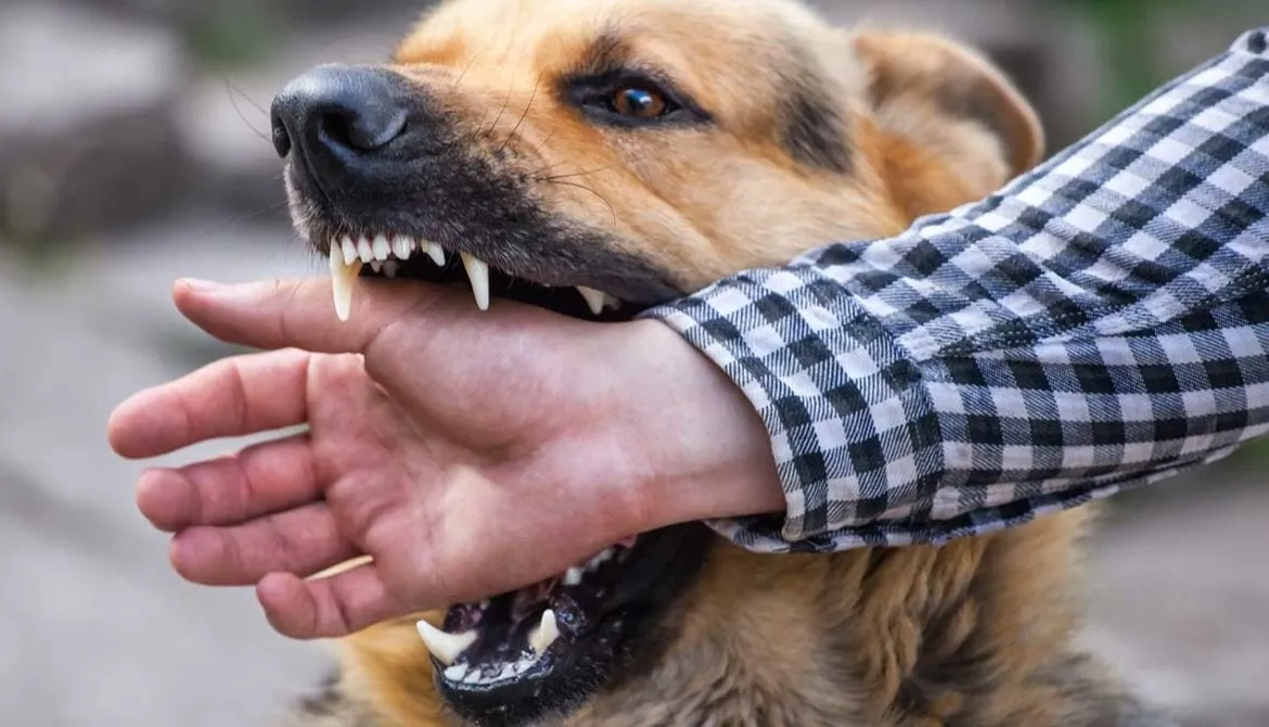 Protecting Your Rights: Personal Injury Law and Hiring a Dog Bite Attorney